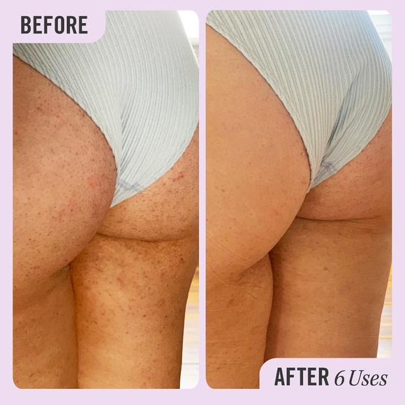 BN First Aid Beauty KP Bump Eraser Body Scrub 10% AHA 2.0 oz NEW - Picture 6 of 6